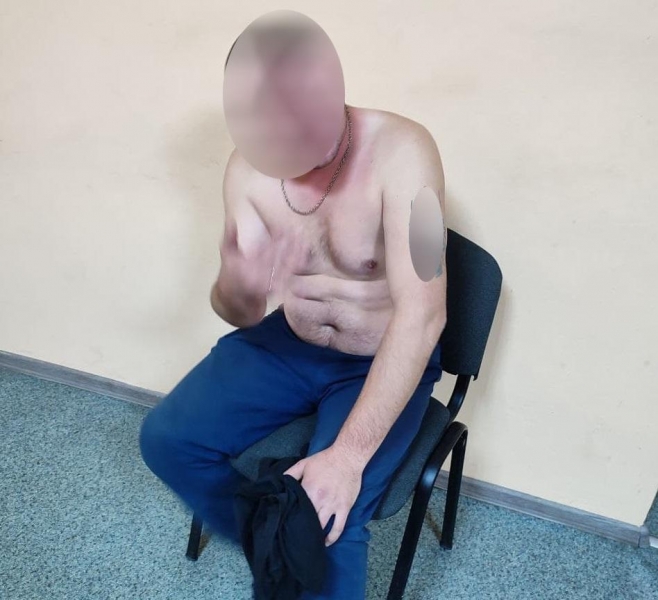 В Днепре мужчина "воспитывал" собаку электрошокером